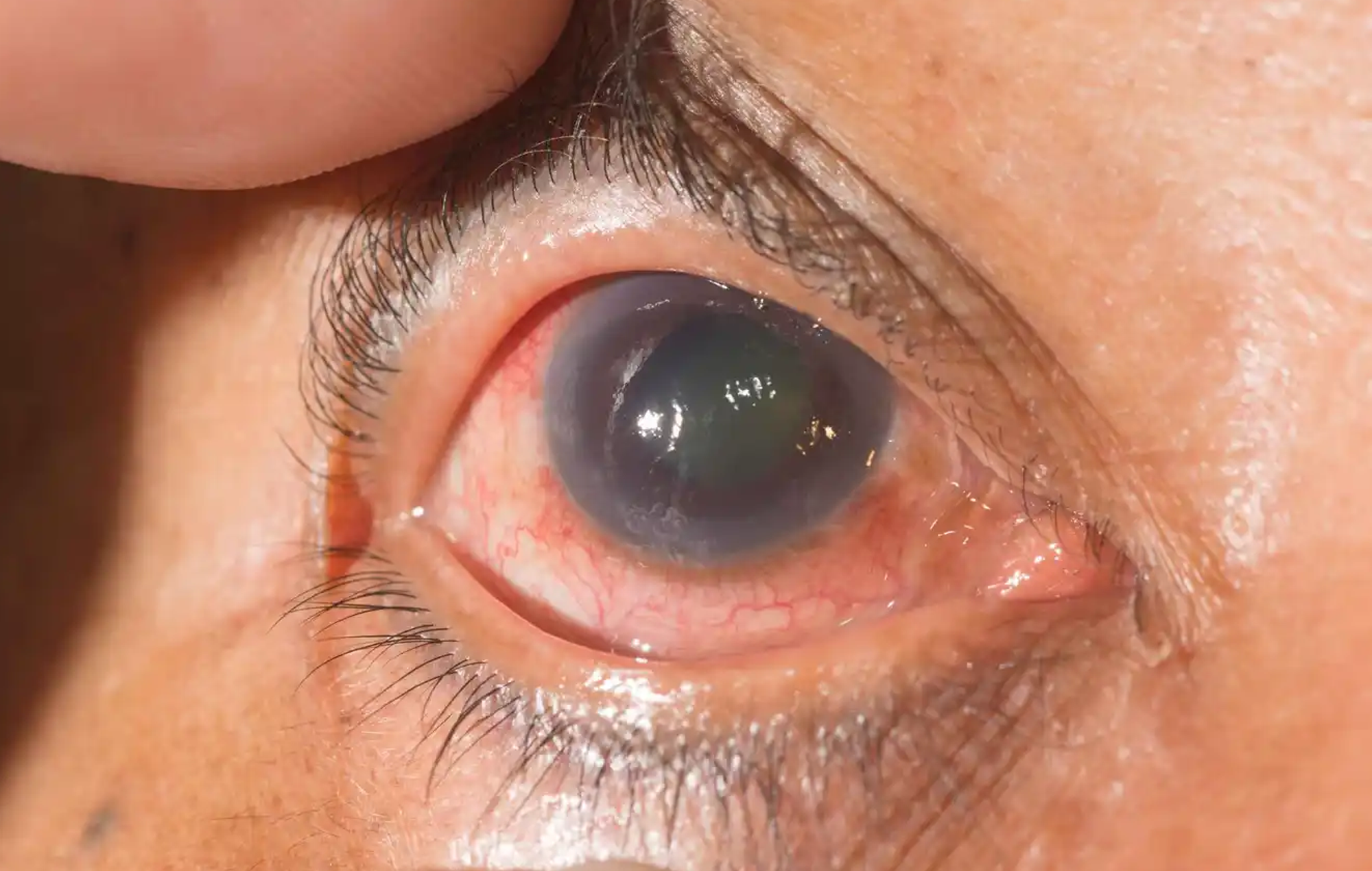 Medical Retina Services